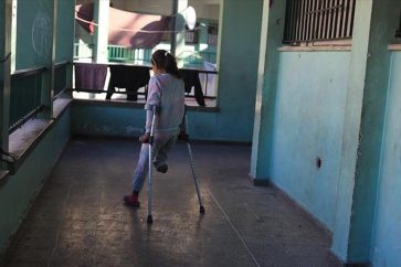 gaza-amputados-1
